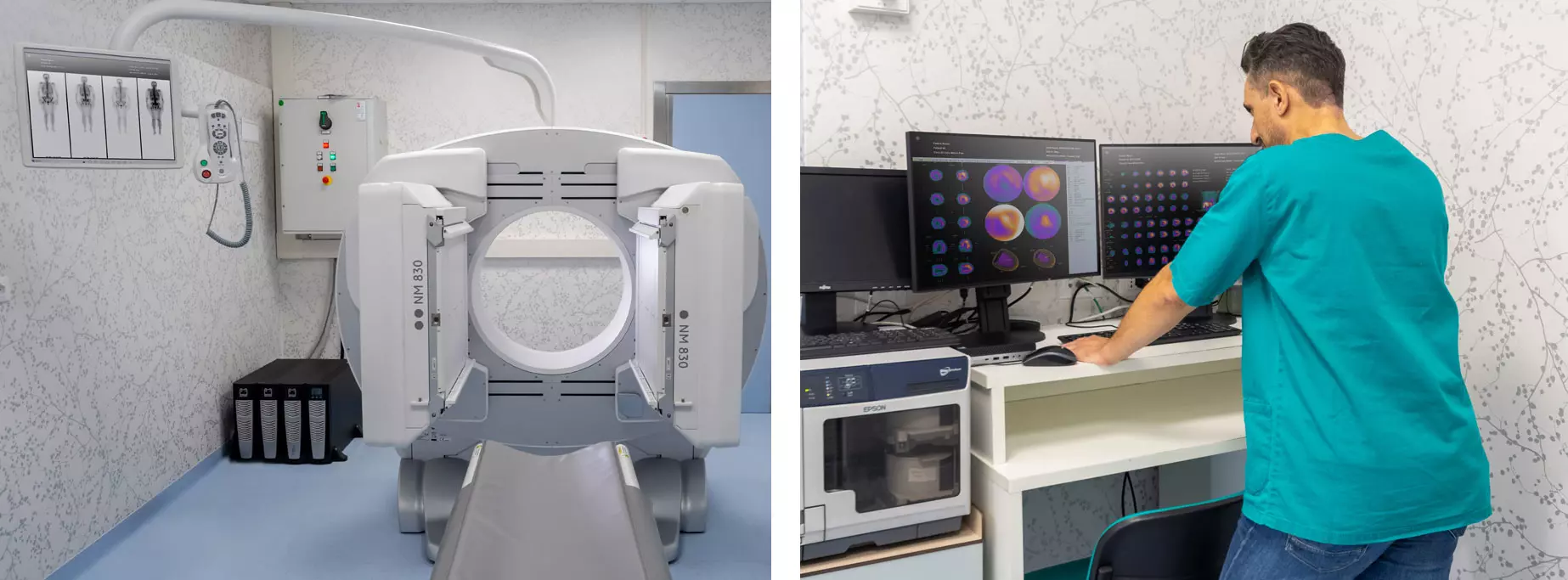 gamma camera e console