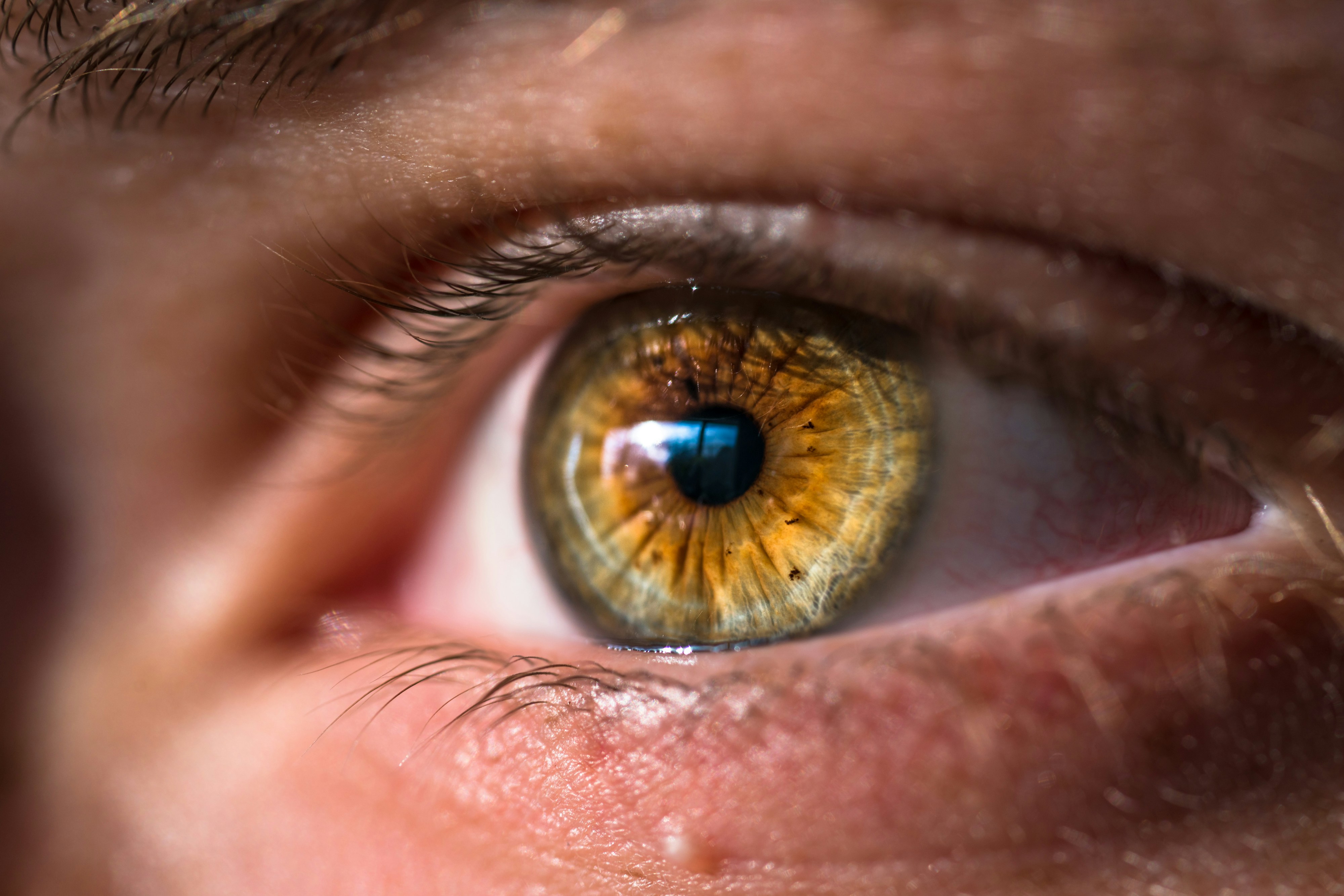 OCT Tomografia Ottica Computerizzata cos a cosa serve e quando  indicata