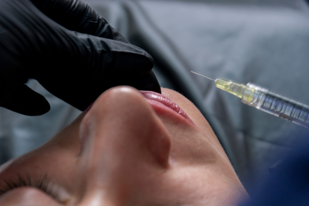 Botox preventivo rivoluzionare lestetica con la prevenzione