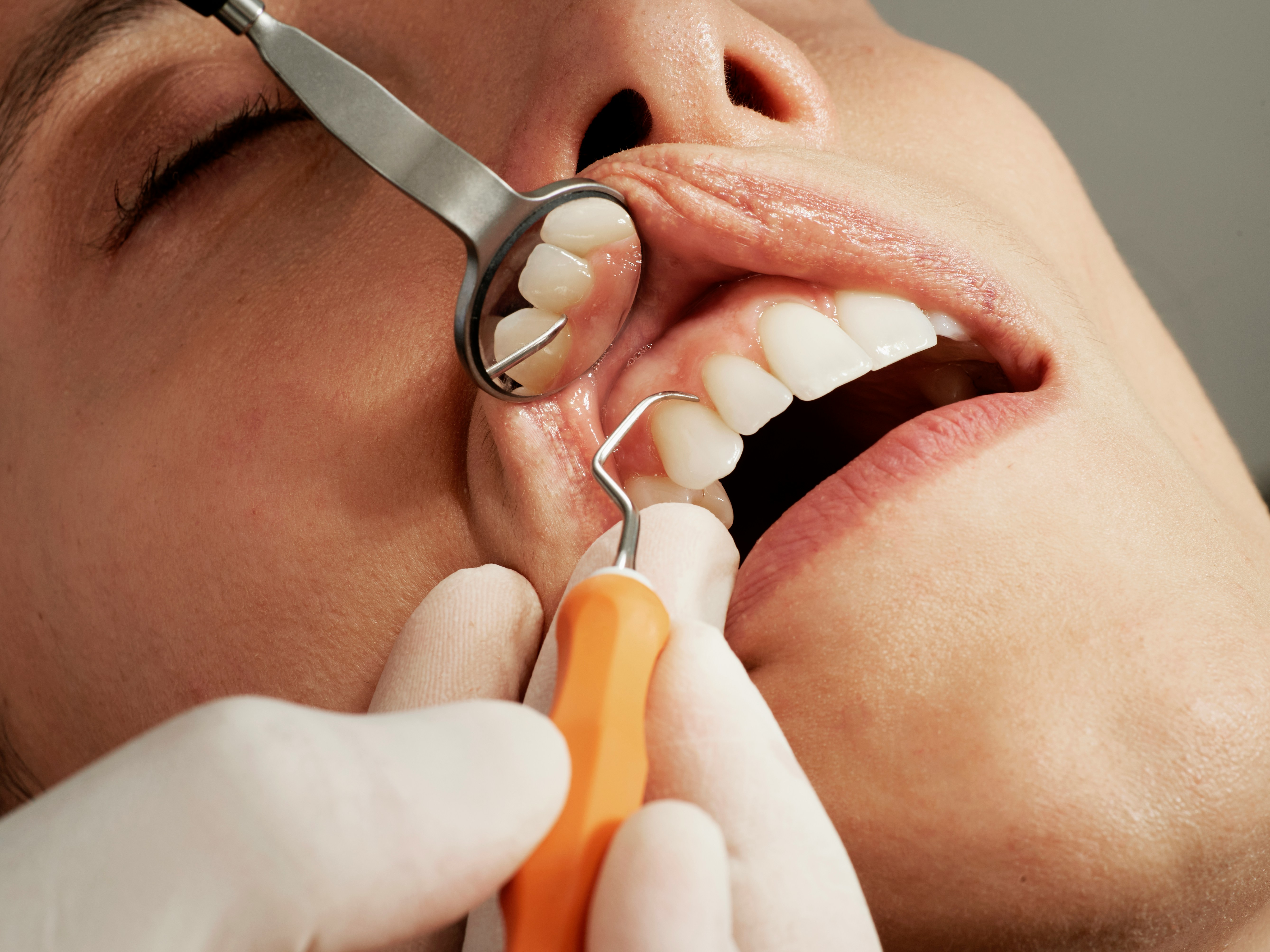Igiene Dentale come e quando effettuarla per una salute orale ottimale