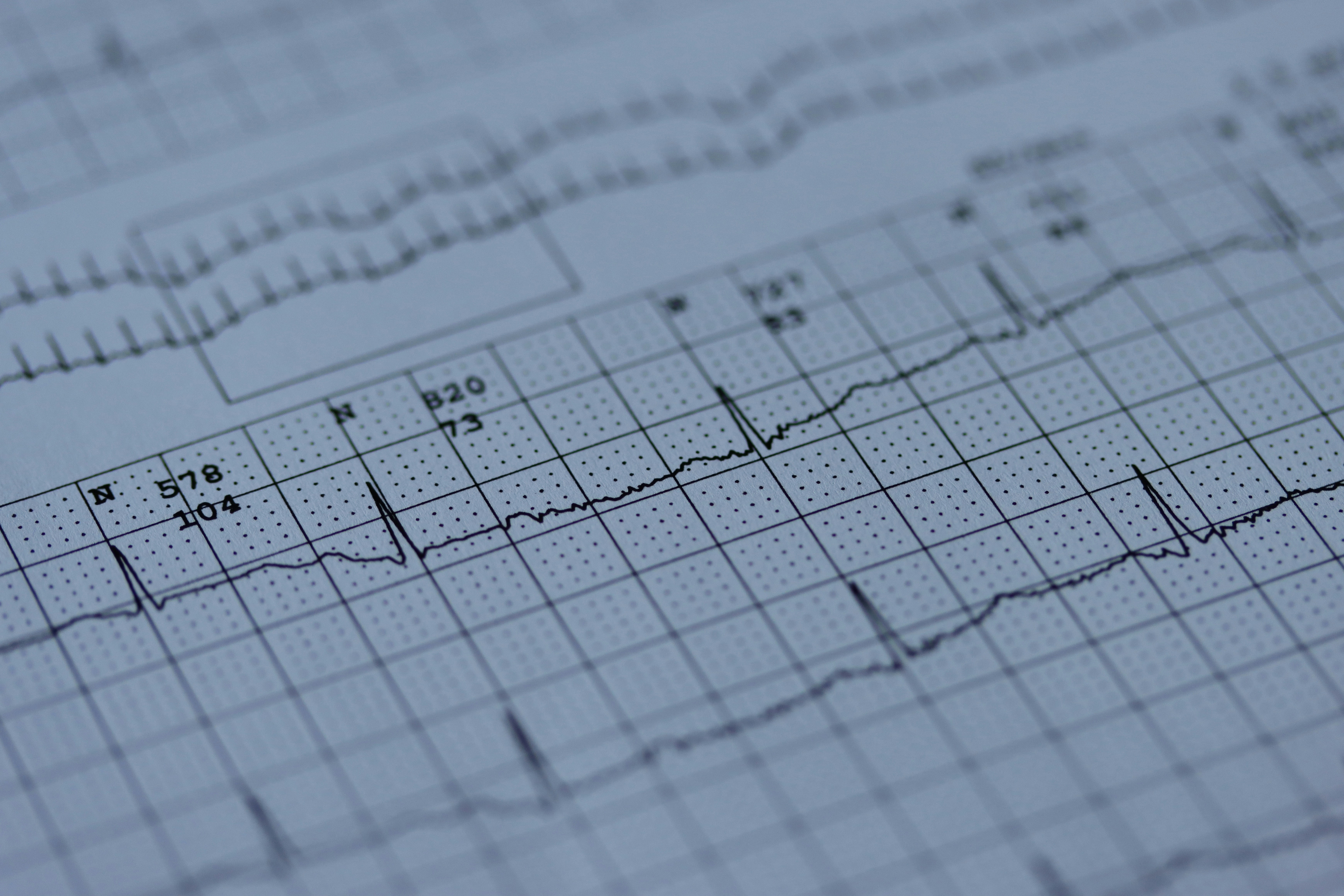ECG un esame semplice e rapido ora disponibile nei punti prelievo USI di Viareggio e Follonica