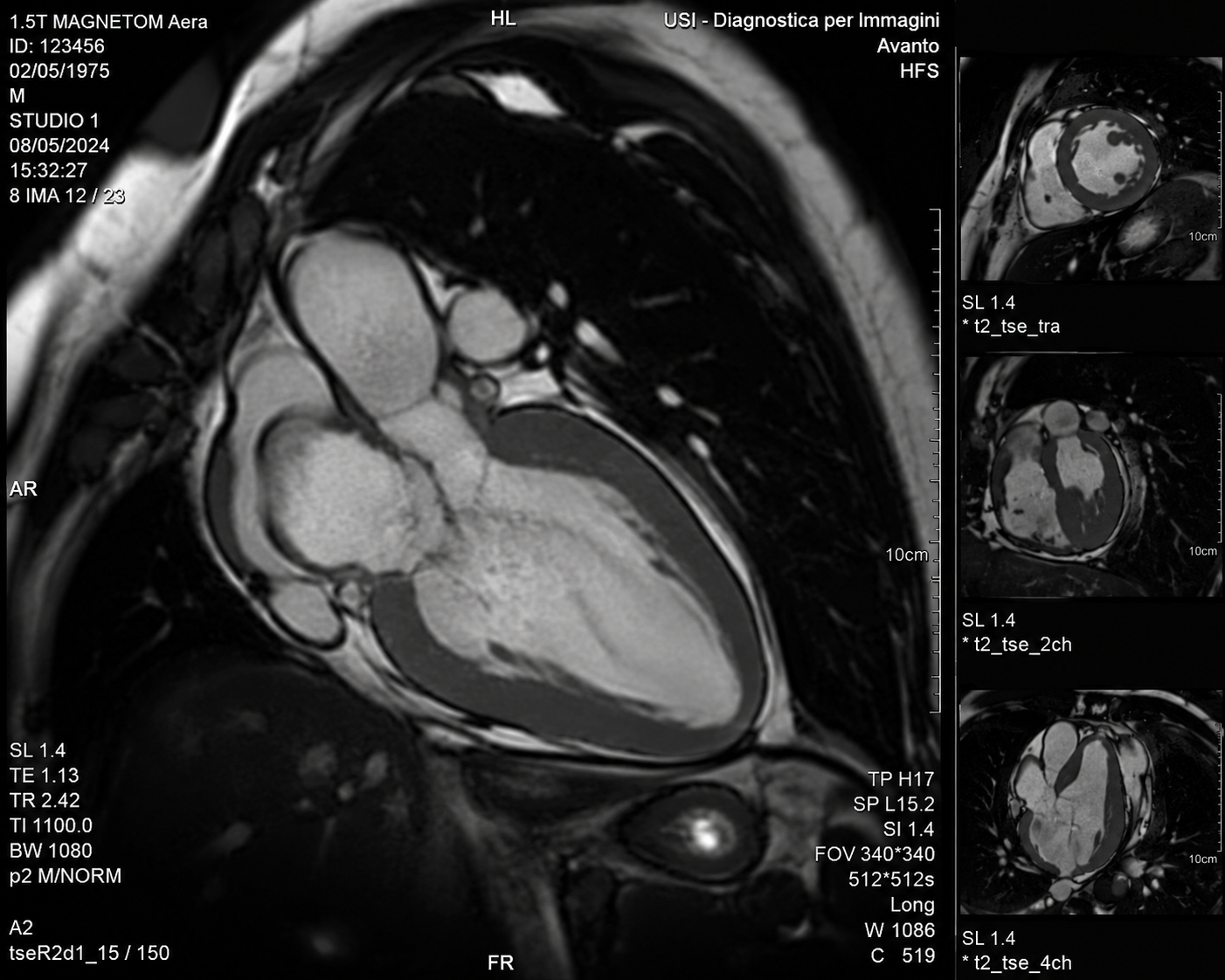 La Risonanza Magnetica Cardiaca una tecnologia avanzata per la diagnostica cardiovascolare