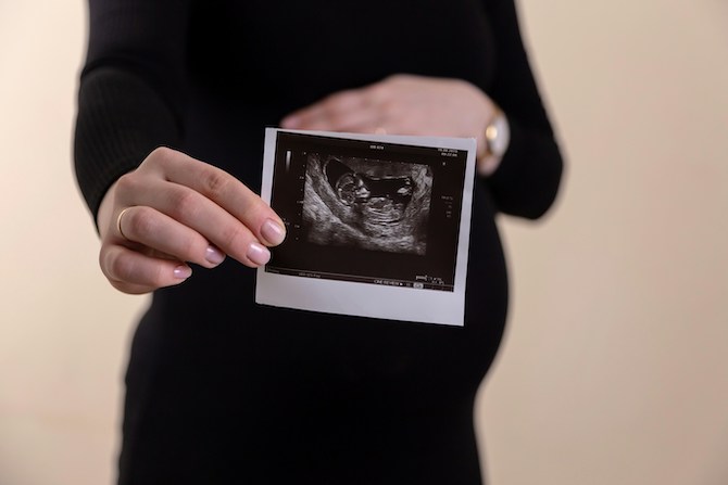 USI Ponsacco Valdera amplia lofferta specialistica con il nuovo servizio di Ginecologia