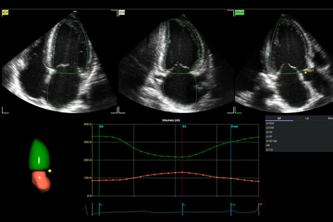 Vivid Pioneer il nuovo sistema ecografico di fascia premium