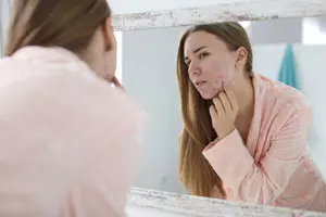 Nuovo Peeling BioRePeelCl3.
