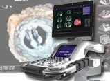 Ecocardiografia 3D: accuratezza diagnostica per tutti i pazienti.