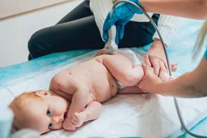 L'ecografia delle anche nel neonato/lattante