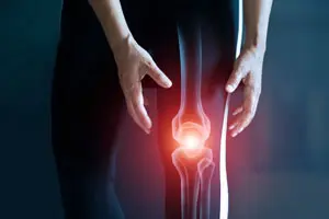 Effetti della terapia con ortesi plantare sul recupero funzionale del ginocchio.