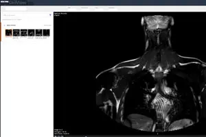 Al via il nuovo servizio U.S.I. per consultare le immagini dei referti radiologici